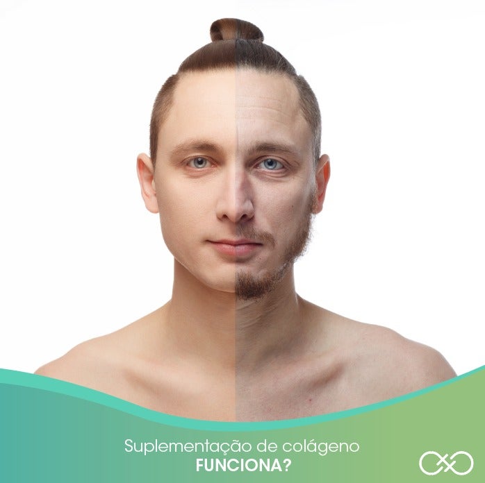 suplmentação-de-colageno