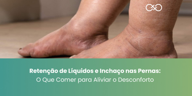 Retenção de Líquidos e Inchaço nas Pernas O que Comer para Aliviar o Desconforto